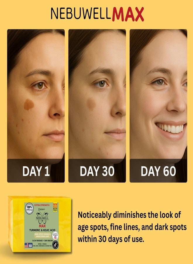 GREENVIFY Nebuwell Max Beauty Turmeric & Kojic Acid Dark Spots Fading Bar, Extra Strength Formula with Retinol, Vitamin C, Shea Oil, Designed in USA - Image 5